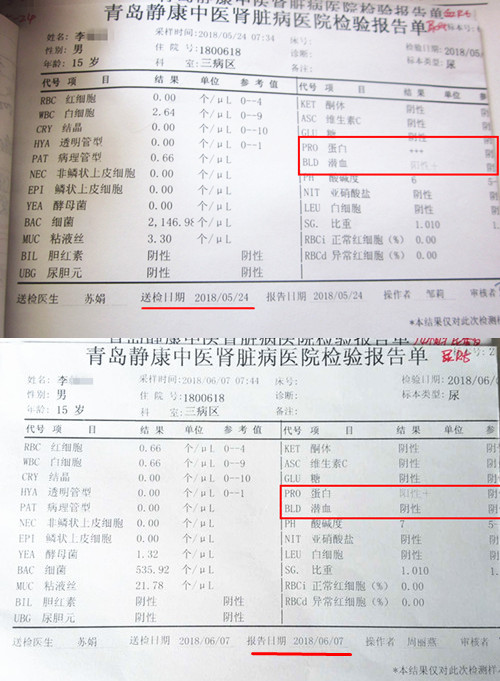 血肌酐正常值最新标准2022，了解与关注的重要性